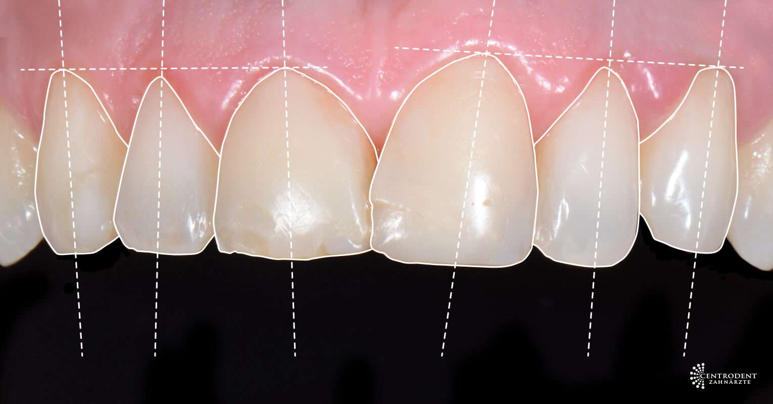 DigitalSmileDesign - Ihre Zahnärzte von Centrodent
