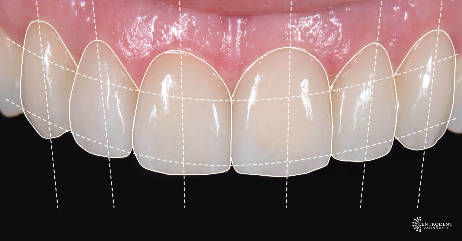 DigitalSmileDesign - Ihre Zahnärzte von Centrodent