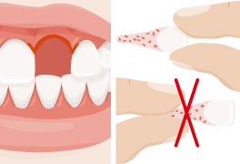 zahnunfall zahn herausgeschlagen